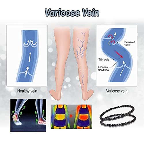 Hion 2 Pack Hematite Therapy Anklet Bracelet for Women/Men